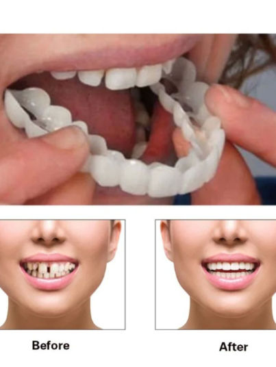 Perfect-Fit-Silicone-Teeth-Whitening-Fake-Tooth-Cover-Snap-On-Sorriso-Folheados-Ferramenta-de-Beleza-Superior